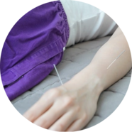 Acupuntura servicios osteovigo